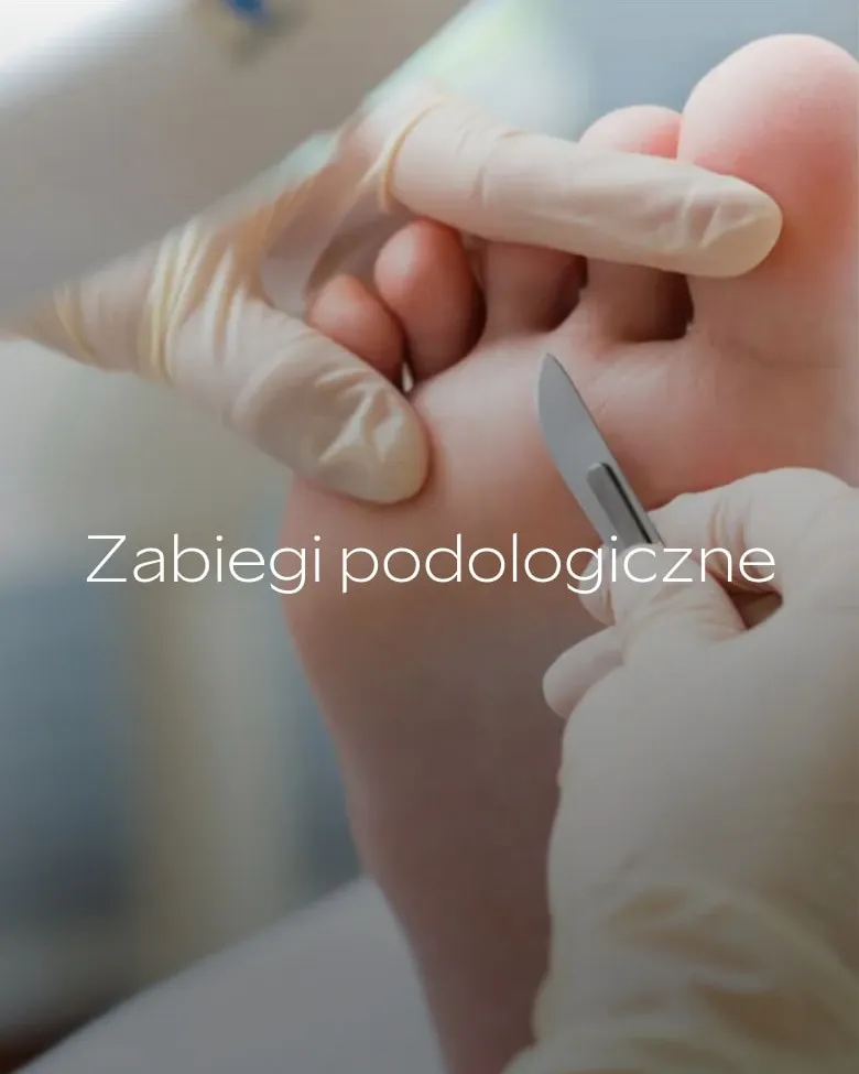 Podstrona „Zabiegi podologiczne” na telefonie